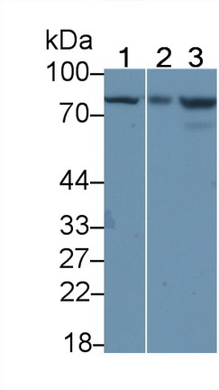 Polyclonal Antibody to Interleukin 18 Receptor 1 (IL18R1)