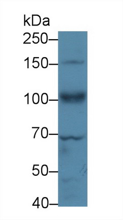Polyclonal Antibody to Insulin Like Growth Factor 1 Receptor (IGF1R)
