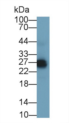 Polyclonal Antibody to Glucocorticoid Induced Tumor Necrosis Factor Receptor (GITR)
