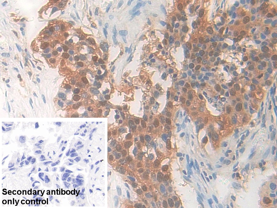 Polyclonal Antibody to Pyridoxal Kinase (PDXK)