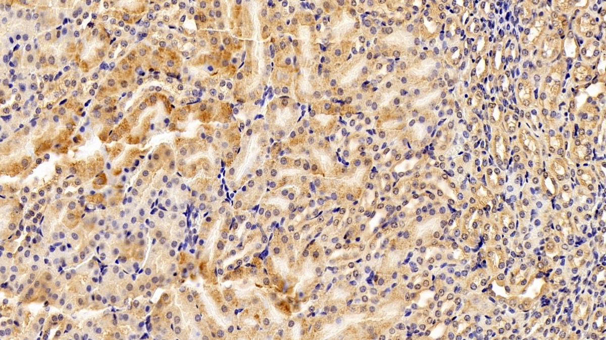 Polyclonal Antibody to Phosphofructokinase, Platelet (PFKP)