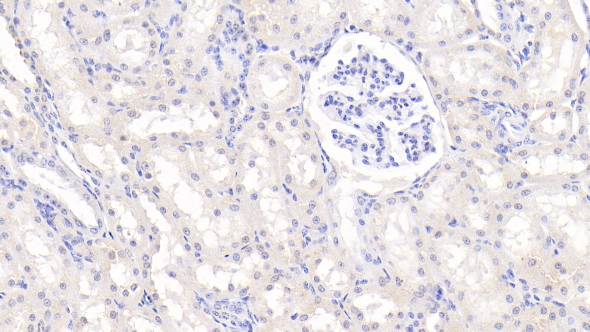 Polyclonal Antibody to Tumor Necrosis Factor Ligand Superfamily, Member 13 (TNFSF13)