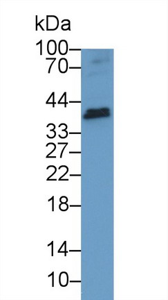Polyclonal Antibody to Tumor Necrosis Factor Ligand Superfamily, Member 13 (TNFSF13)