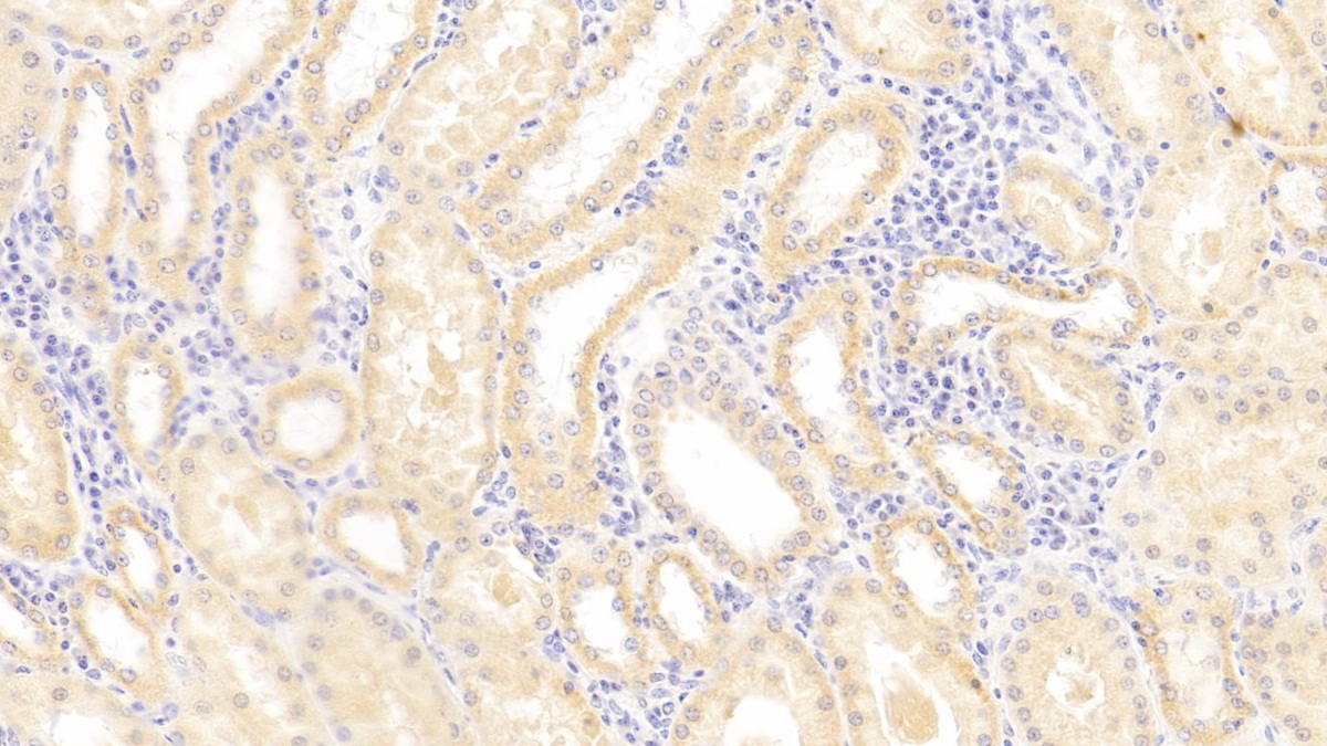 Polyclonal Antibody to Major Histocompatibility Complex Class I E (MHCE)
