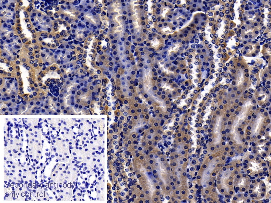 Polyclonal Antibody to Orosomucoid 2 (ORM2)