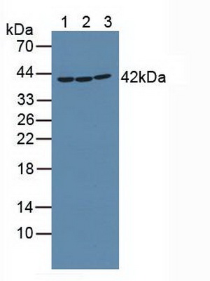 Polyclonal Antibody to Receptor Interacting Serine Threonine Kinase 2 (RIPK2)