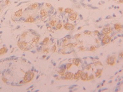 Polyclonal Antibody to Fibroblast Growth Factor Receptor 1 (FGFR1)