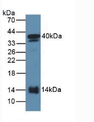 Polyclonal Antibody to Serum Amyloid A2 (SAA2)