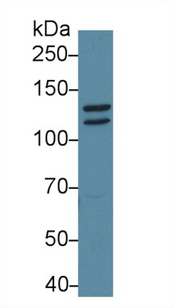 Polyclonal Antibody to Signal Transducer And Activator Of Transcription 2 (STAT2)