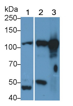 Polyclonal Antibody to Signal Transducer And Activator Of Transcription 2 (STAT2)