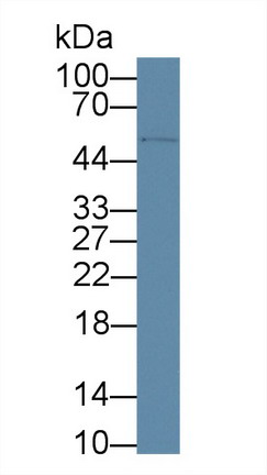 Polyclonal Antibody to Cluster Of Differentiation 5 (CD5)