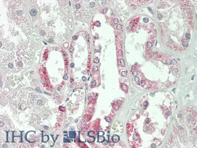 Polyclonal Antibody to Jagged 1 (JAG1)