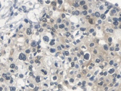 Polyclonal Antibody to Squamous Cell Carcinoma Antigen 1/2 (SCCA1/SCCA2)