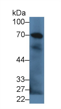 Polyclonal Antibody to Complement Component 9 (C9)