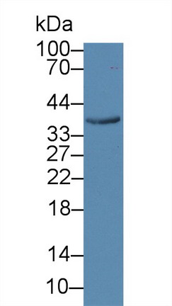 Polyclonal Antibody to Calumenin (CALU)