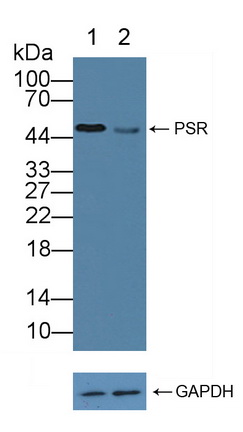 Polyclonal Antibody to Phosphatidylserine Receptor (PSR)