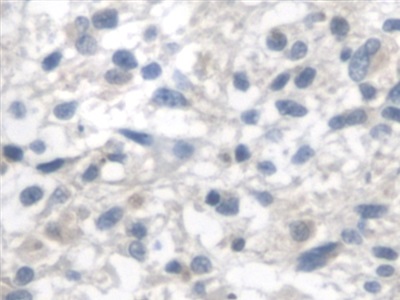 Polyclonal Antibody to Fumarase (FUM)