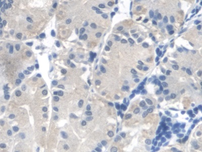 Polyclonal Antibody to Fumarase (FUM)