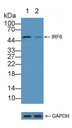 Polyclonal Antibody to Interferon Regulatory Factor 6 (IRF6)