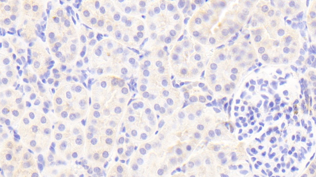 Polyclonal Antibody to Complement Factor I (CFI)