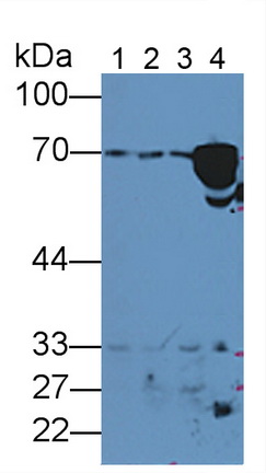 Polyclonal Antibody to Hemopexin (HPX)