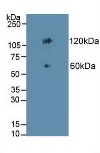 Polyclonal Antibody to Cadherin 17 (CDH17)