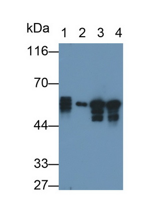 Polyclonal Antibody to Cytokeratin 8 (CK8)