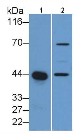 Polyclonal Antibody to Creatine Kinase B (CK-BB)