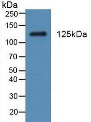Polyclonal Antibody to Platelet Derived Growth Factor Receptor Alpha (PDGFRa)