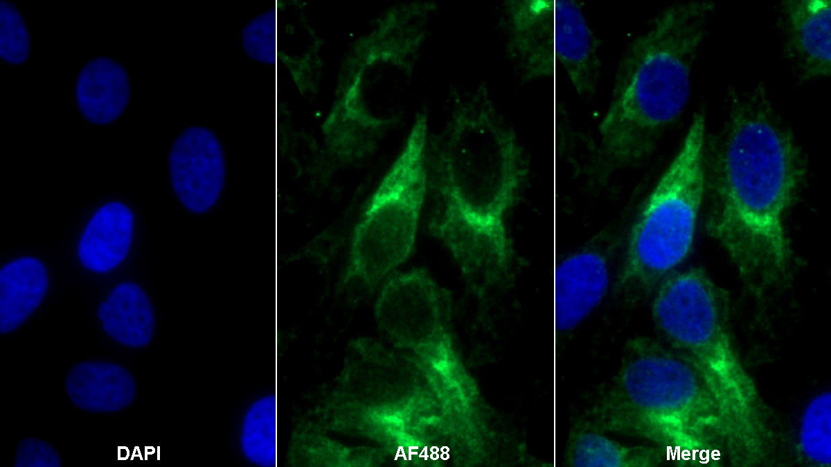 Polyclonal Antibody to Platelet Derived Growth Factor Receptor Alpha (PDGFRa)