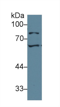 Polyclonal Antibody to Fibroblast Growth Factor Receptor Substrate 2 (FRS2)