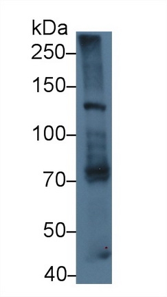 Polyclonal Antibody to Laminin Beta 3 (LAMb3)