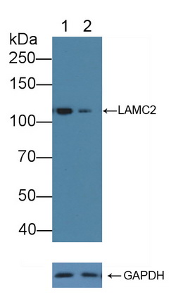 Polyclonal Antibody to Laminin Gamma 2 (LAMC2)