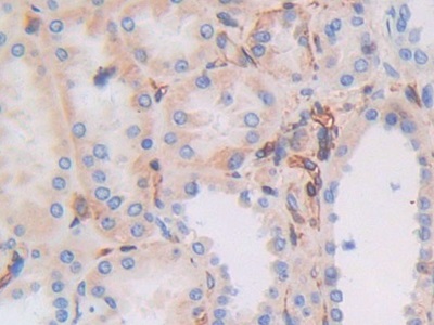 Polyclonal Antibody to Major Histocompatibility Complex Class I C (MHCC)