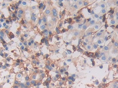 Polyclonal Antibody to Major Histocompatibility Complex Class I C (MHCC)
