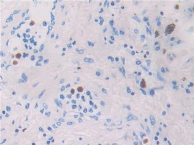 Polyclonal Antibody to Macrophage Inflammatory Protein 4 Alpha (MIP4a)