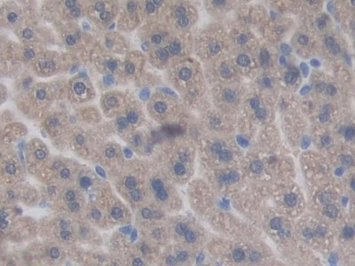 Polyclonal Antibody to Chordin (CHRD)