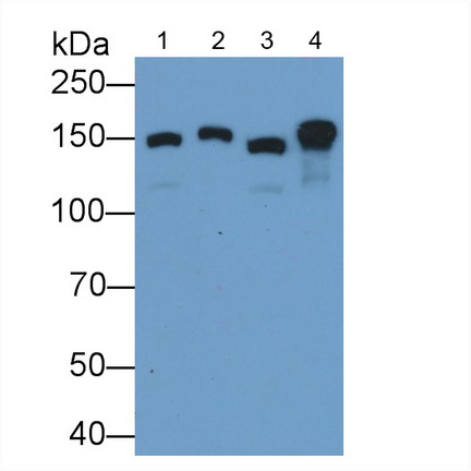 Polyclonal Antibody to Collagen Type VI Alpha 1 (COL6a1)