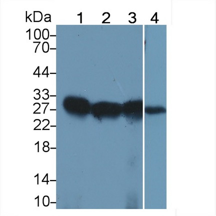 Polyclonal Antibody to HLA Class II Histocompatibility Antigen, DRB1 Beta Chain (HLA-DRB1)