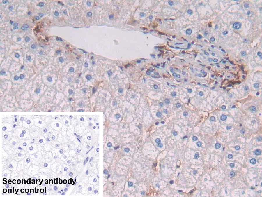 Polyclonal Antibody to HLA Class II Histocompatibility Antigen, DRB1 Beta Chain (HLA-DRB1)