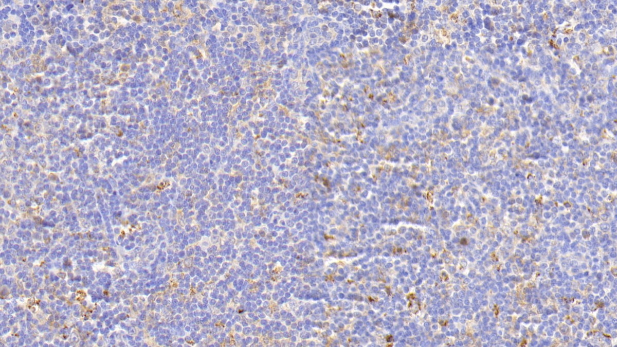 Polyclonal Antibody to Glial Cell Line Derived Neurotrophic Factor Receptor Alpha 2 (GFRa2)