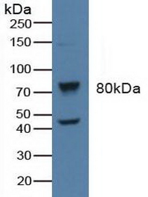 Polyclonal Antibody to Beta Adrenergic Receptor Kinase (BARK)