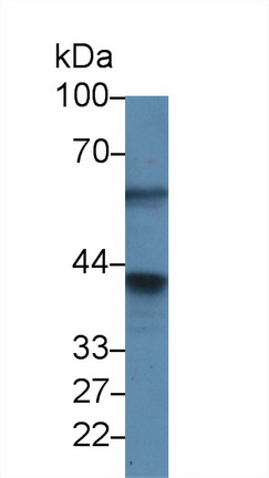 Polyclonal Antibody to Protein Phosphatase 1, Catalytic Subunit Alpha Isoform (PPP1Ca)