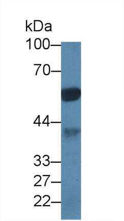 Polyclonal Antibody to Protein Phosphatase 1, Catalytic Subunit Alpha Isoform (PPP1Ca)