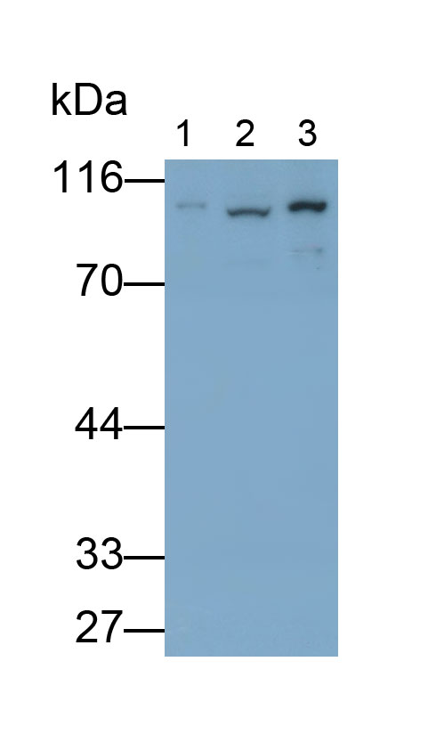 Polyclonal Antibody to Catenin Alpha 1 (CTNNa1)