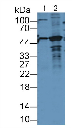 Polyclonal Antibody to Bleomycin Hydrolase (BLMH)