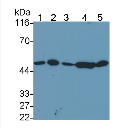 Polyclonal Antibody to Protein Kinase B Alpha (PKBa)