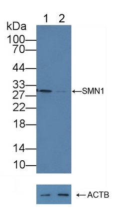 Polyclonal Antibody to Survival Motor Neuron Protein (SMN)