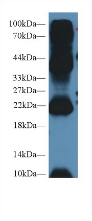 Polyclonal Antibody to Anterior Gradient 2 (AGR2)