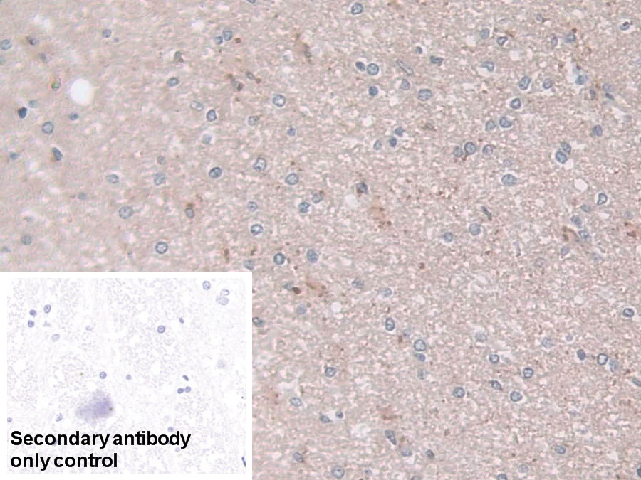 Polyclonal Antibody to N-Acylsphingosine Amidohydrolase 1 (ASAH1)